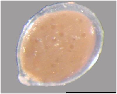 Sinks and Sources of Intracellular Nitrate in Gromiids